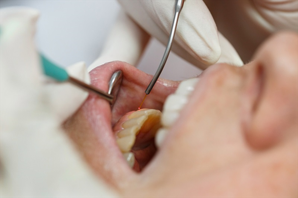 fight gum disease with laser dentistry